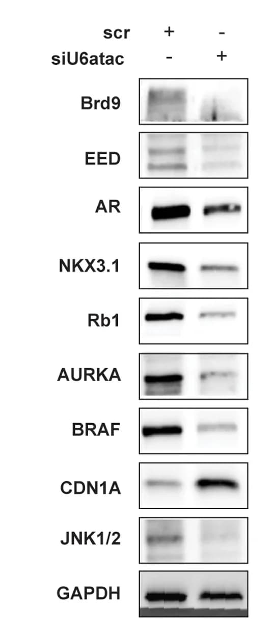 Open access visualization of Gel, Immunoblot, Protein Expression, Mass Spectrometry, C4-2 Cells