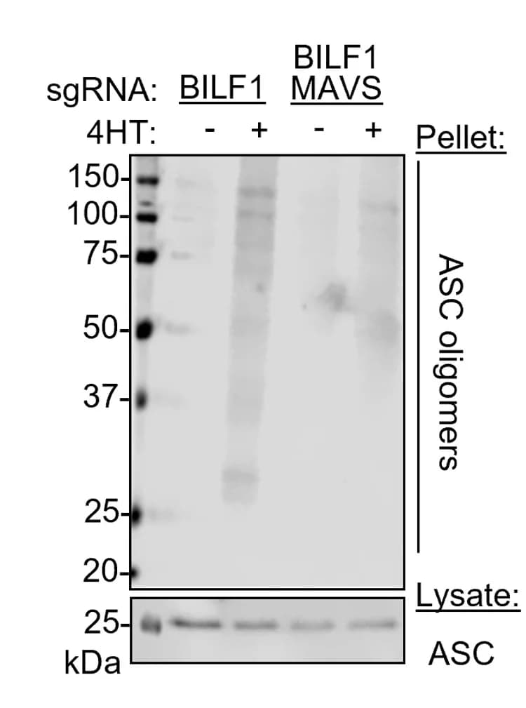 Open access visualization of Gel, Immunoblot, ASC, Oligomerization, P3HR-1 Cells
