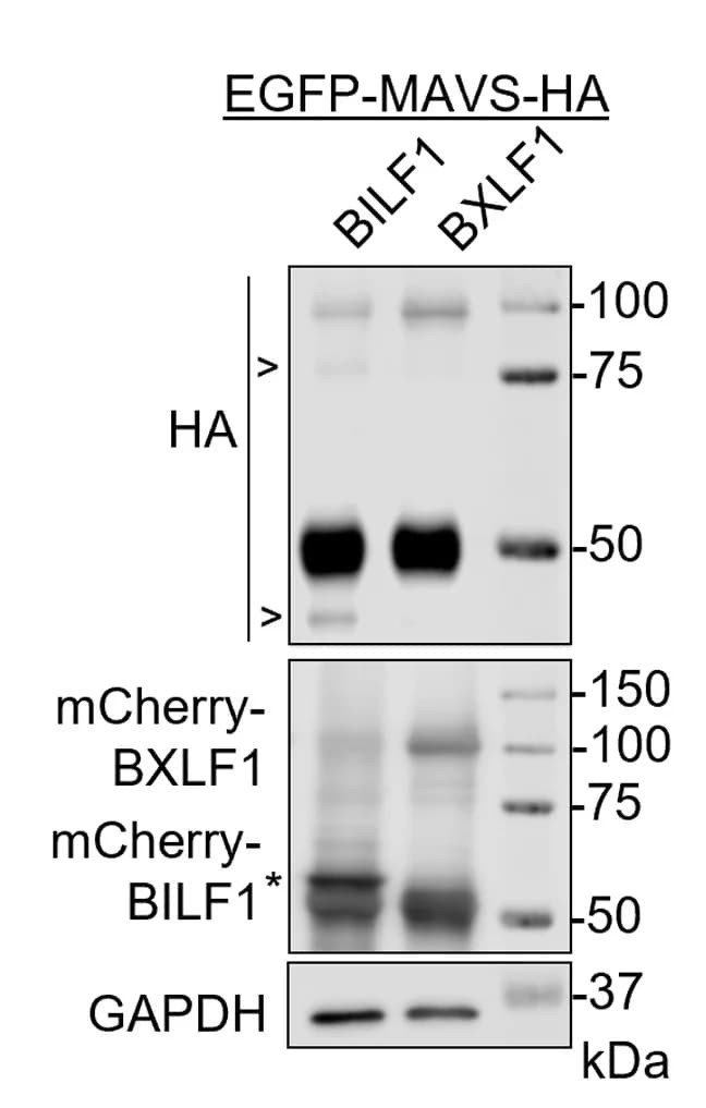 Open access visualization of Gel, Immunoblot, 293T Cells, cDNA