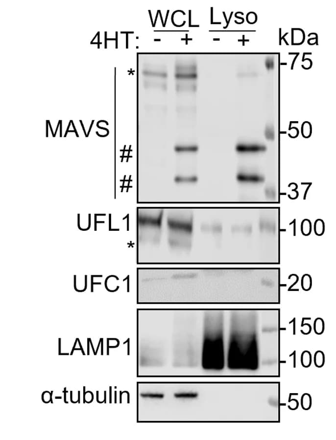 Open access visualization of Gel, Immunoblot, HA-TMEM192, Lysosomes, P3HR-1 cells