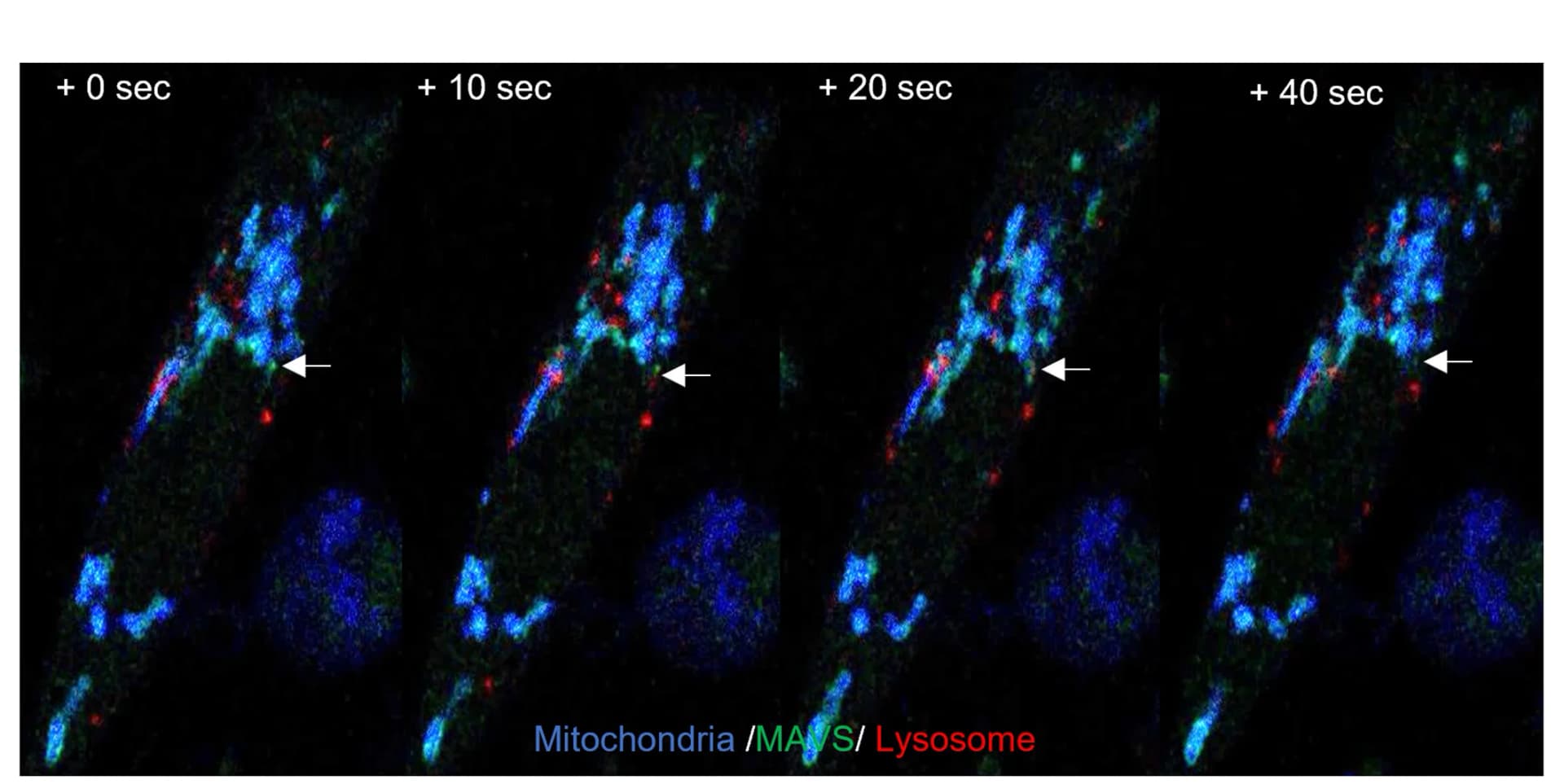 Open access visualization of Microscopy, Time-lapse microscopy, GFP-MAVS, Mitochondria, Lysosomes