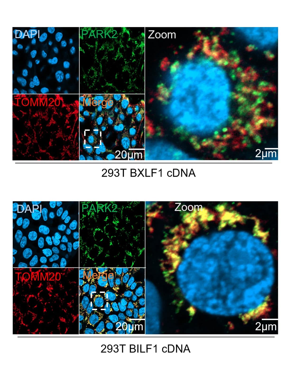 Open access visualization of Microscopy, PAKR2, TOMM20, Immunofluorescence Analysis, 293T