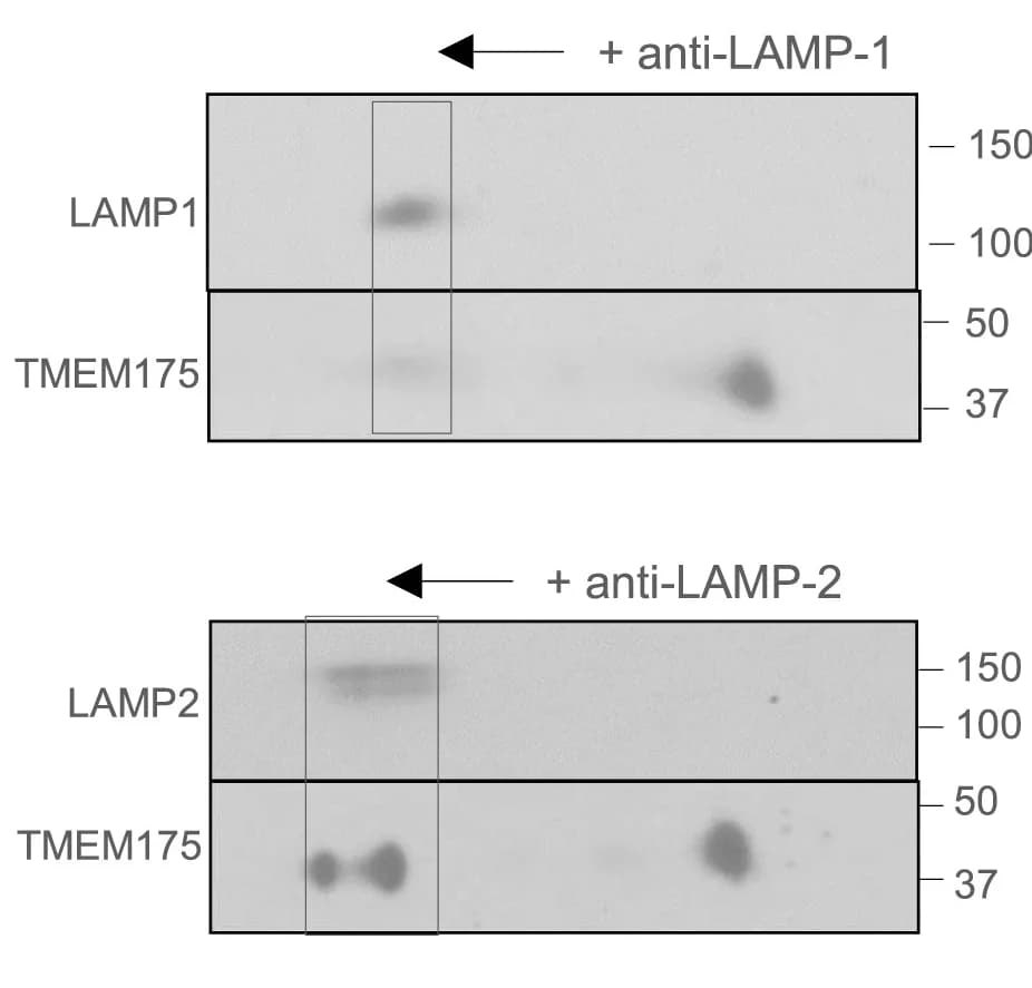 Open access visualization of Gel, 2D Gel Electrophoresis, SH-SY5Y Cells, LAMP Proteins, Mobility Shift