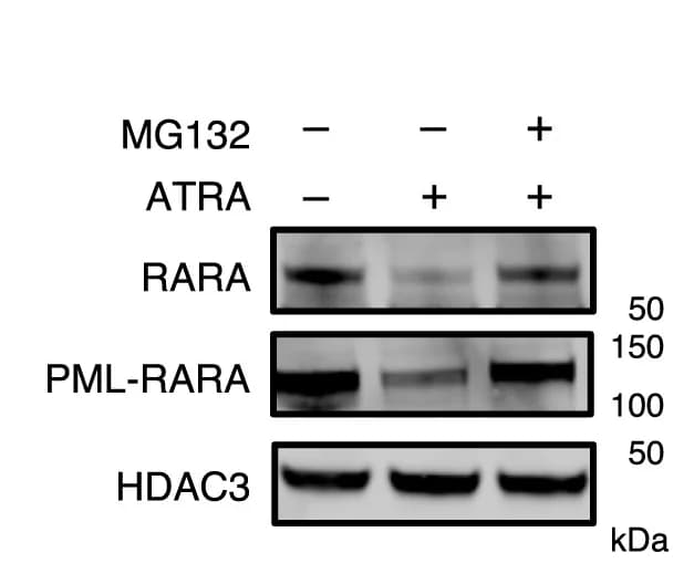 Open access visualization of Gel, Western Blotting, PML-RARA, RARA, HDAC3