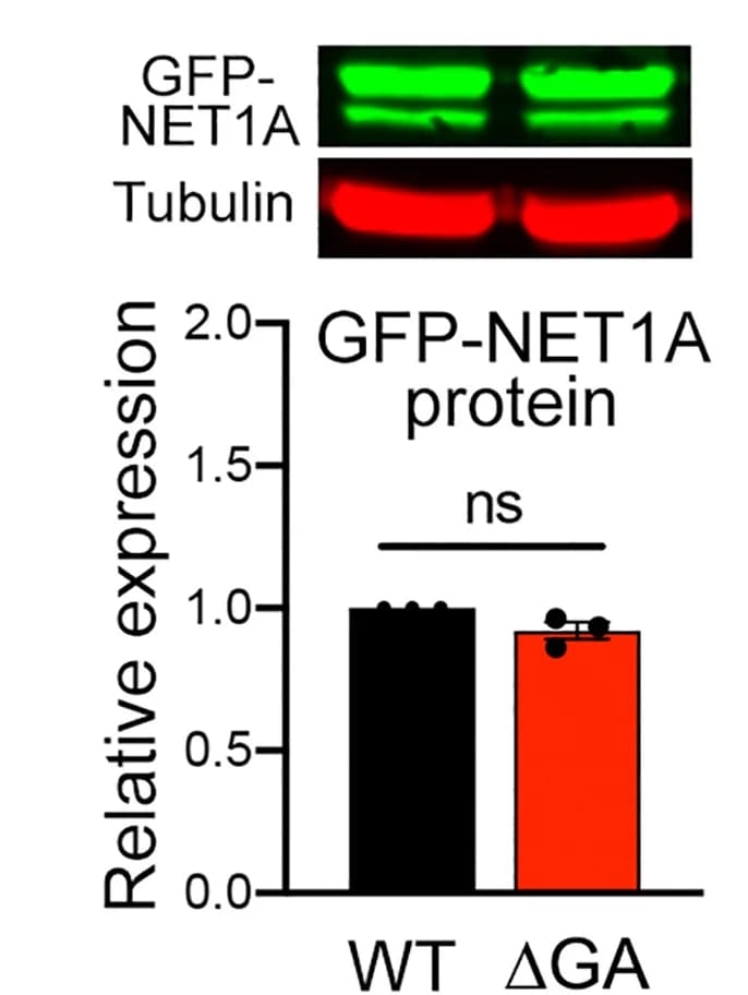 Open access visualization of Bar Plot, Error Bars, GFP-NET1A, Protein Levels, Western Blot