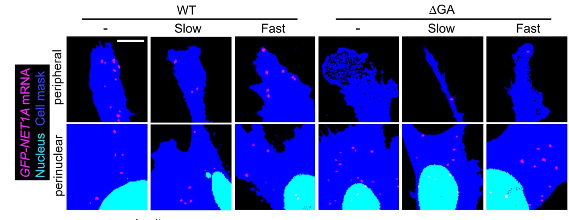 Open access visualization of Microscopy, FISH images, GFP-NET1A mRNA, Stable cell lines, Perinuclear regions