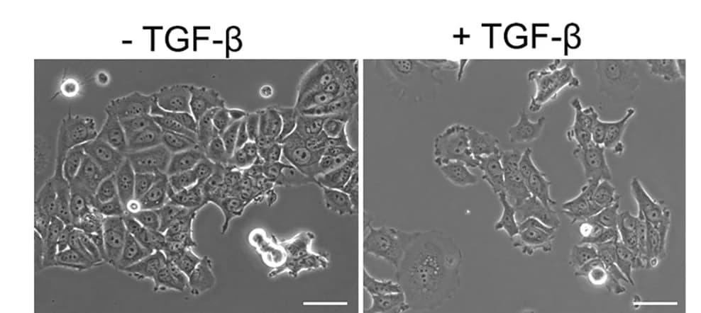 Open access visualization of Microscopy, Photo, Phase Contrast, MCF7 Cells, TGF-β