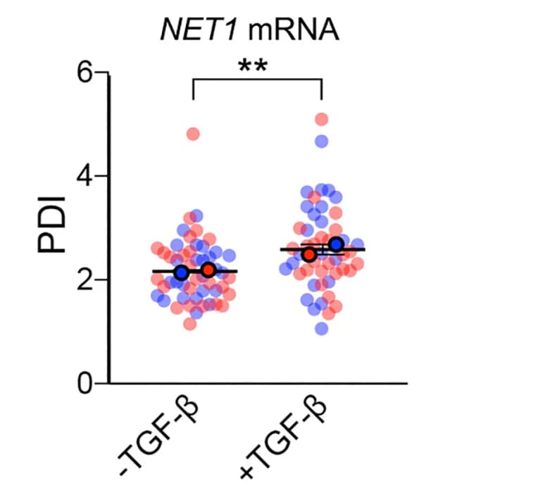 Open access visualization of Scatter Plot, PDI, NET1 mRNA, MCF7 Cells, TGF-β