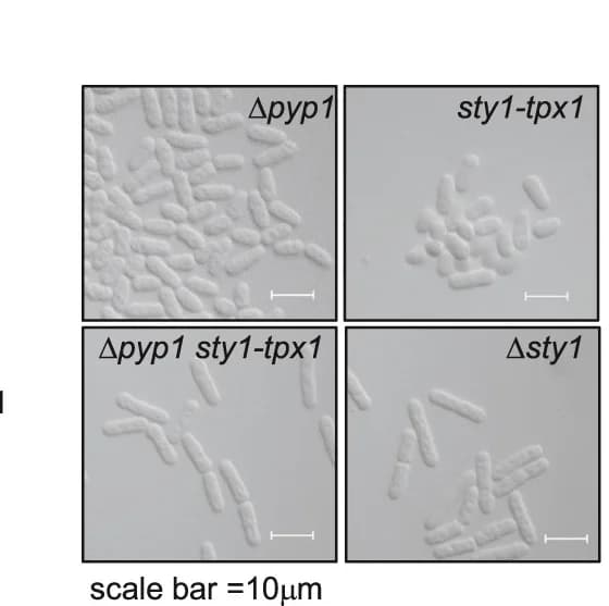 Open access visualization of Microscopy, DIC Microscopy, Pyp1 Cells, Sty1-Tpx1 Cells, Pyp1 Sty1-Tpx1 Cells