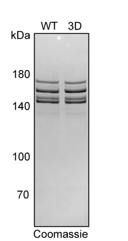 Open access visualization of Gel, Coomassie staining, Recombinant cohesin, Cohesin 3D, Insect cells