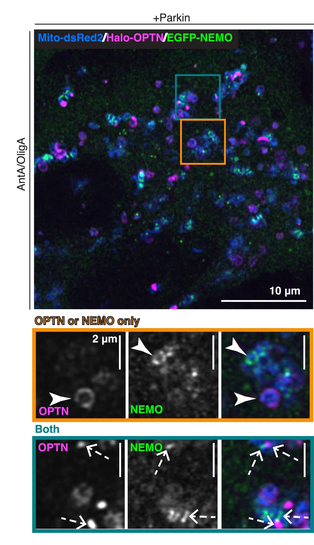 Open access visualization of Microscopy, Airyscan Image, HeLa Cell, EGFP-NEMO, Halo-OPTN