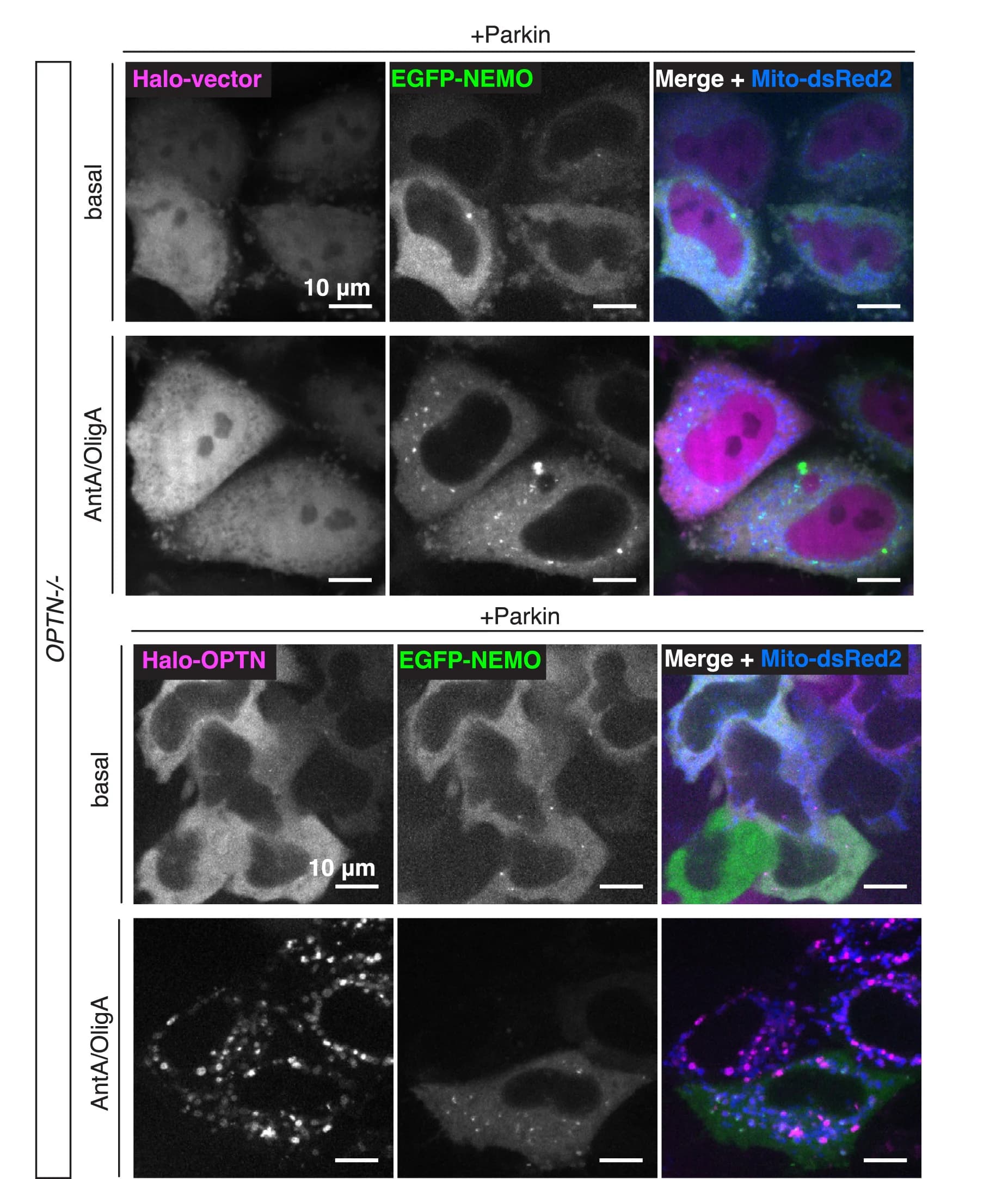 Open access visualization of Microscopy, OPTN Knockout Cells, EGFP-NEMO, Mito-dsRed2, Parkin