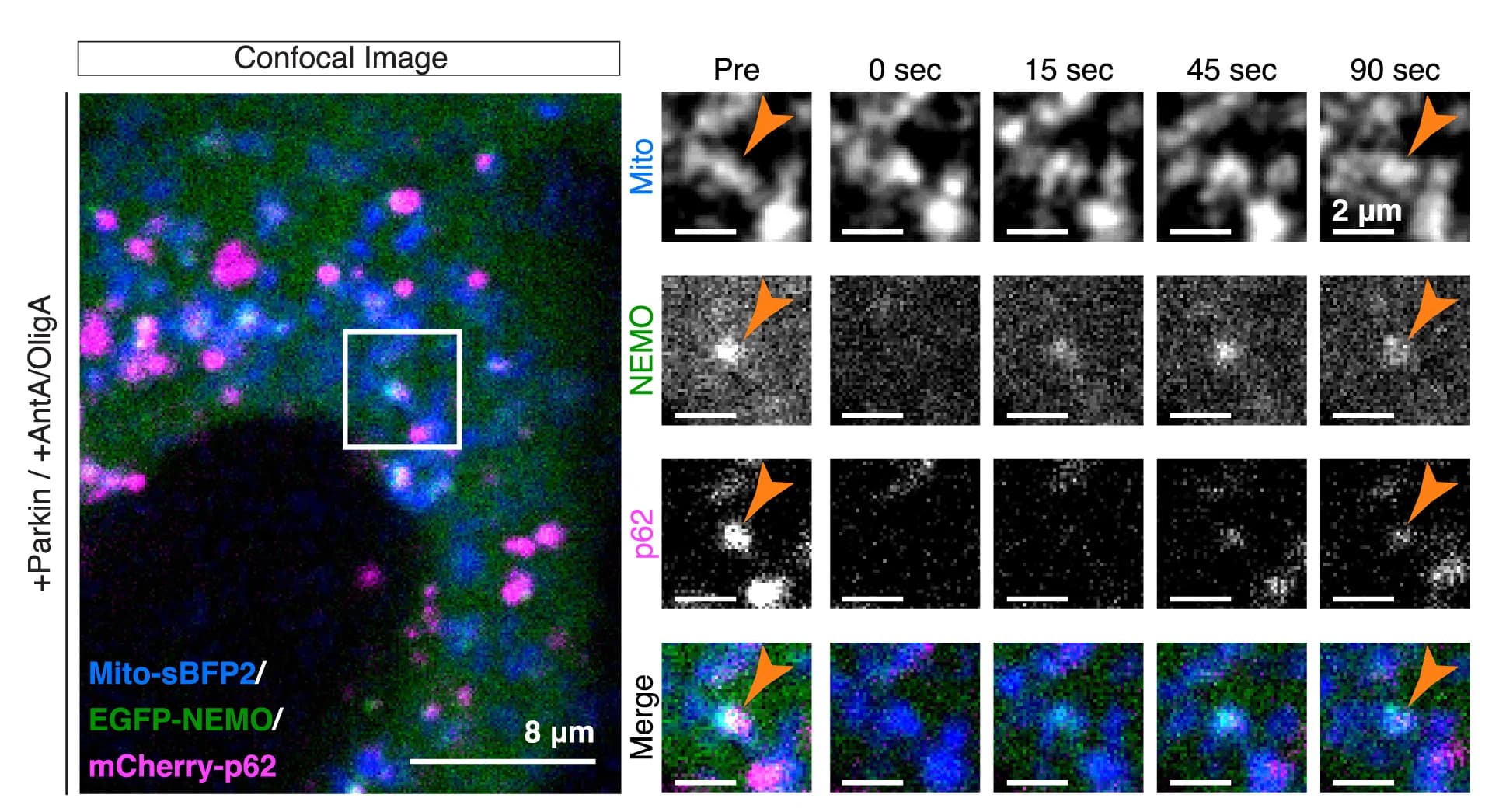 Open access visualization of Microscopy, Confocal Image, HeLa Cell, EGFP-NEMO, mCherry-p62