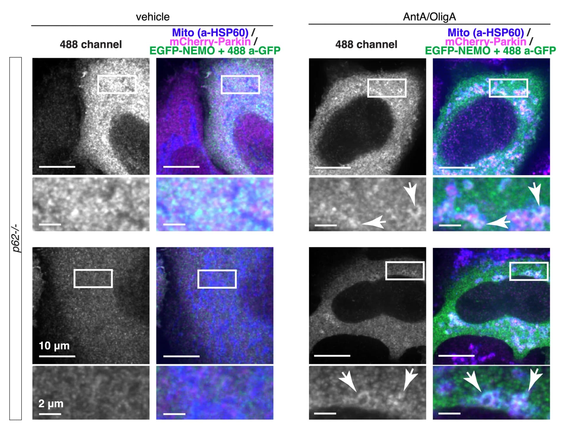 Open access visualization of Microscopy, p62-/- Cells, mCherry-Parkin, EGFP-NEMO, HSP60
