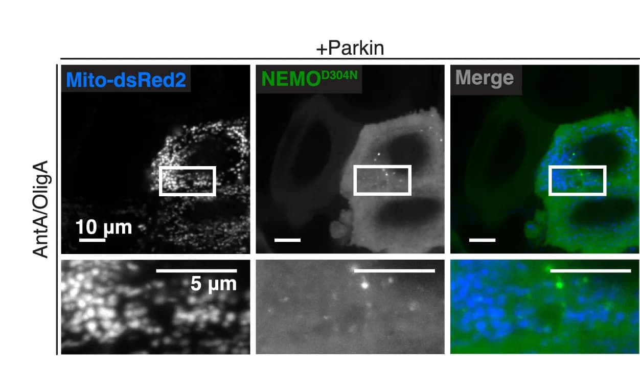 Open access visualization of Microscopy, HeLa Cells, EGFP-NEMOD304N, Mito-dsRed2, Parkin