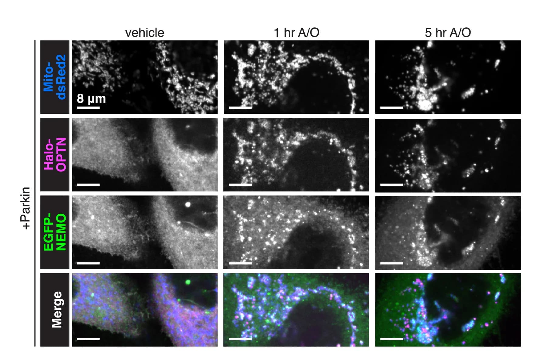 Open access visualization of Microscopy, HeLa Cells, Mito-dsRed2, Halo-OPTN, EGFP-NEMO