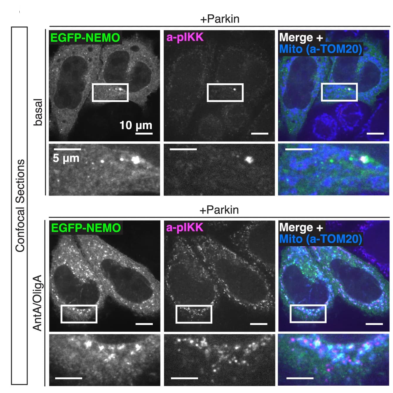 Open access visualization of Microscopy, HeLa Cell, EGFP-NEMO, Parkin, TOM20