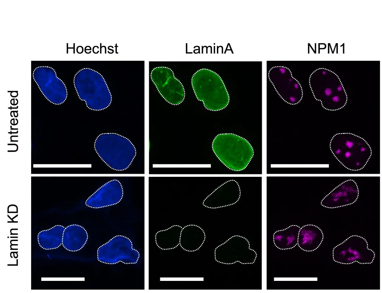 Open access visualization of Microscopy, Nucleoli, siRNA Knockdown, Lamin A