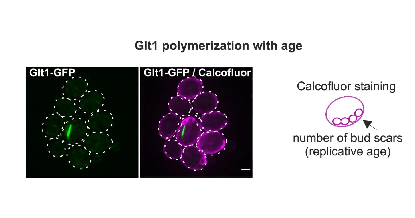 Open access visualization of Microscopy, Illustration, Glt1, GFP, Young Cells