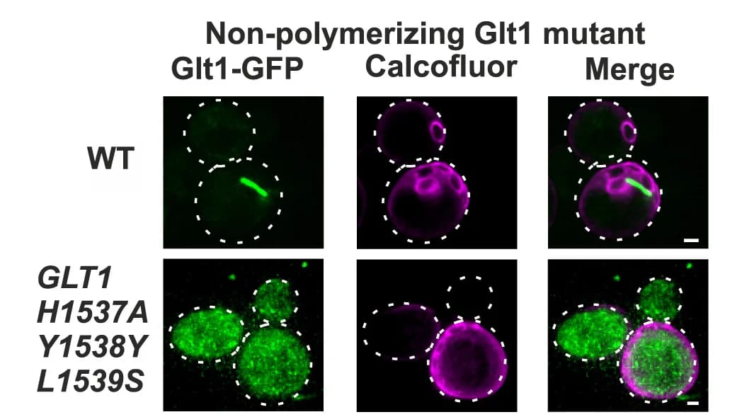 Open access visualization of Microscopy, WT Cells, Glt1 Mutants, GFP, Mutant Cells