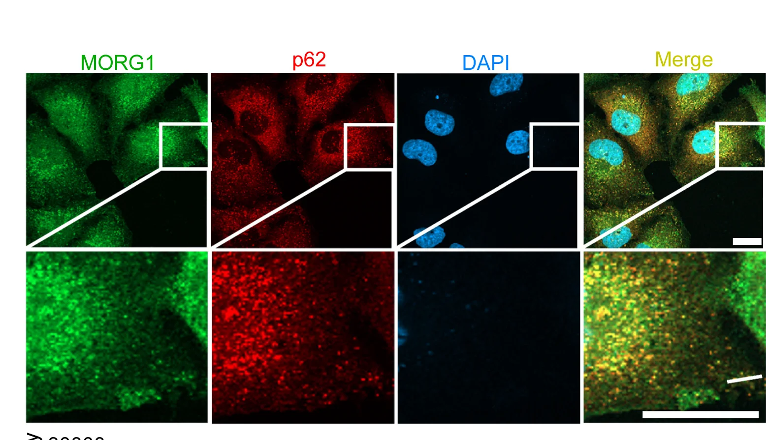 Open access visualization of Microscopy, HeLa Cells, Immunofluorescence, p62, MORG1