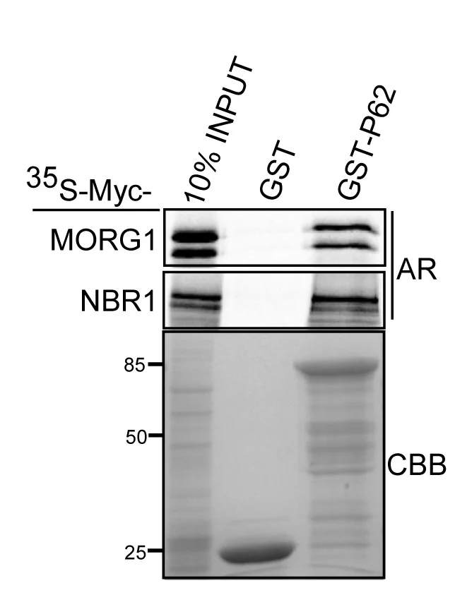 Open access visualization of Gel, MORG1, p62/SQSTM1, GST Pull-Down Assay, In Vitro Translation