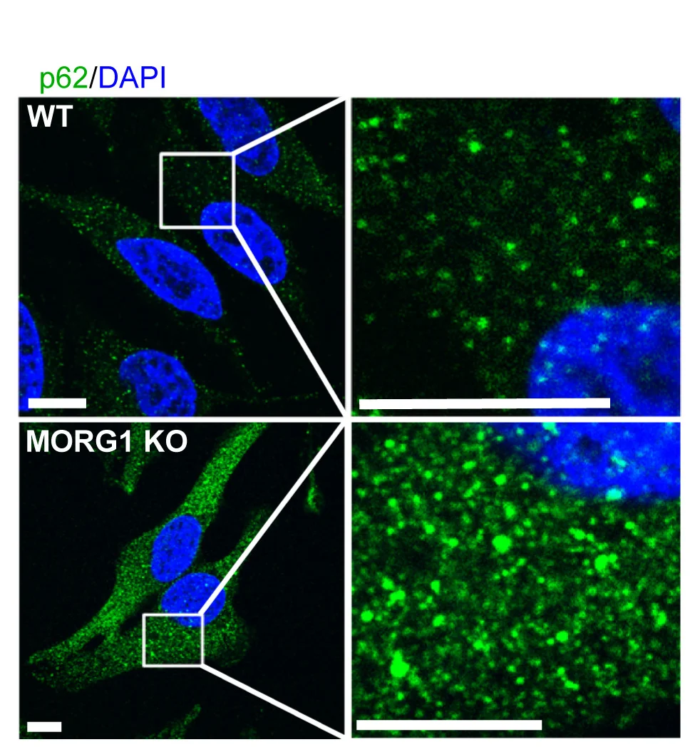 Open access visualization of Microscopy, HeLa Cells, Wild-Type, MORG1 Knockout, Immunofluorescence