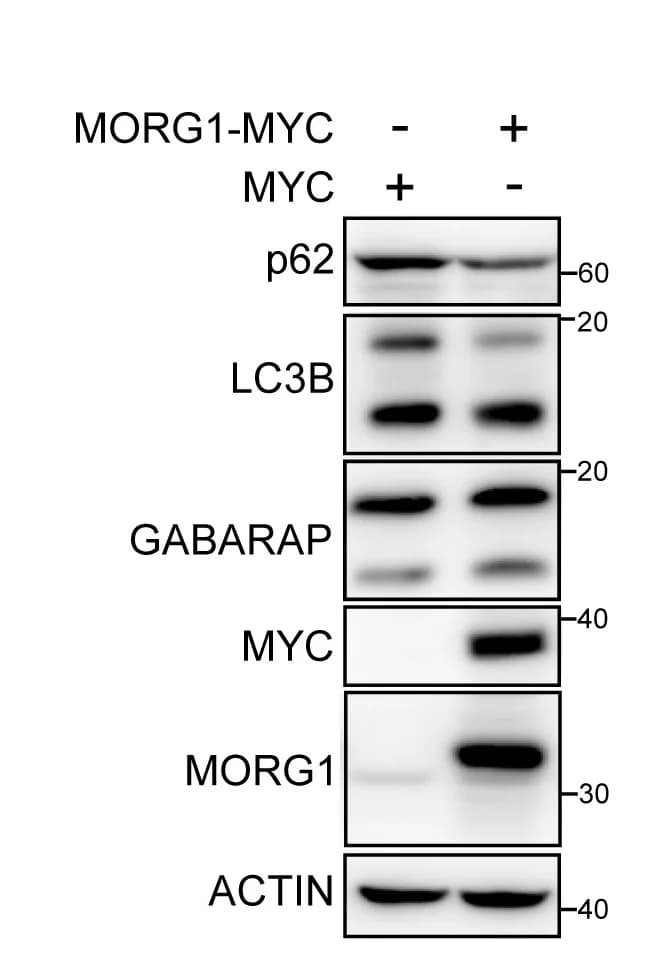 Open access visualization of Gel, HeLa Cells, Myc-tagged MORG1, Immunoblot, Proteins