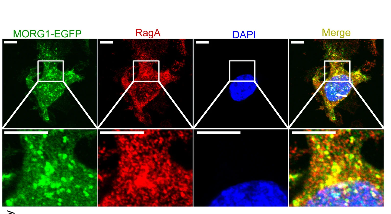Open access visualization of Microscopy, MORG1, HeLa Cells, EGFP, RagA