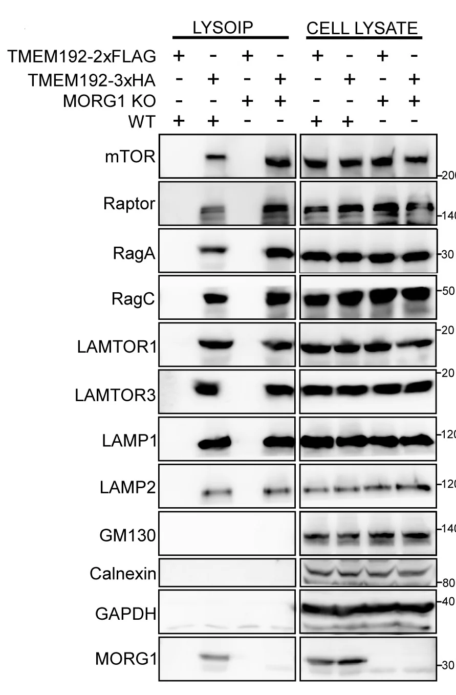 Open access visualization of Gel, LysoIP, HeLa WT Cells, MORG1 KO Cells, TMEM192-3xHA
