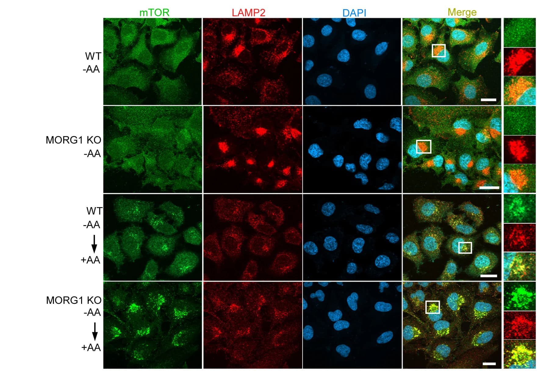 Open access visualization of Microscopy, HeLa WT Cells, MORG1 KO Cells, Amino-Acid-Free Media, Amino Acid Stimulation