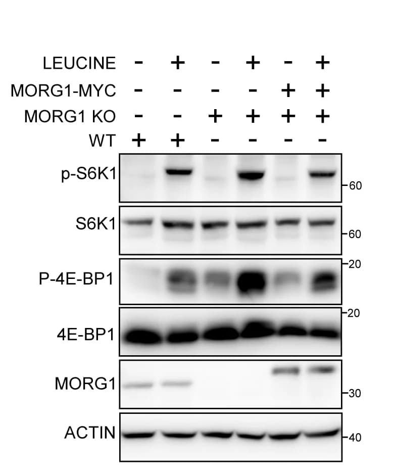 Open access visualization of Gel, Immunoblots, Quantification, mTORC1 Substrates, HeLa WT Cells
