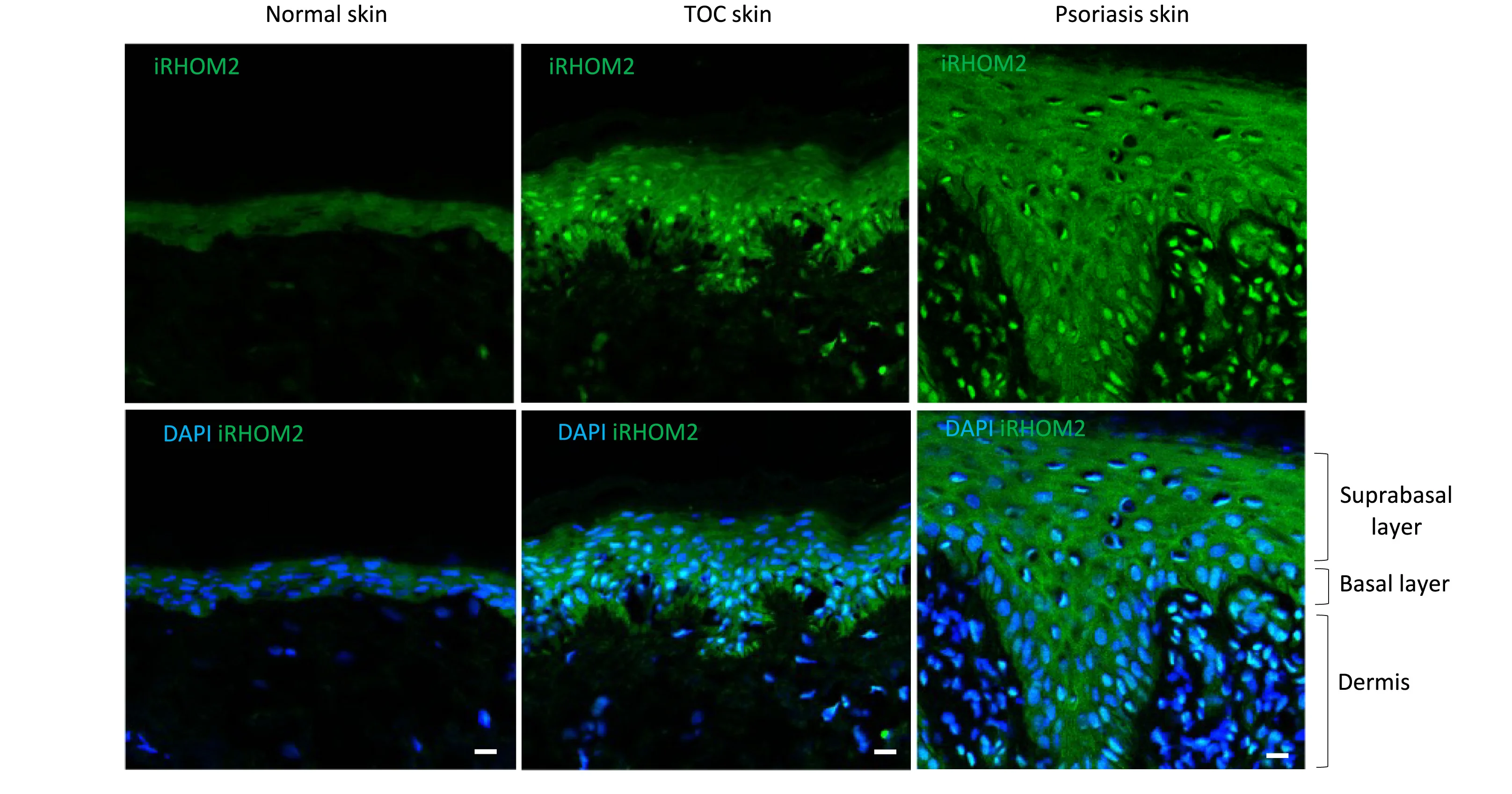 Open access visualization of Microscopy, iRhom2, Immunohistochemistry, Basal Layer, Suprabasal Layer