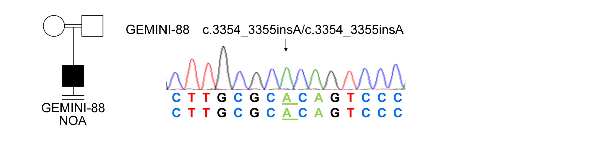 Open access visualization of Line Plot, Workflow, Pedigree, Sequencing Trace, SPOCD1 Exon 16
