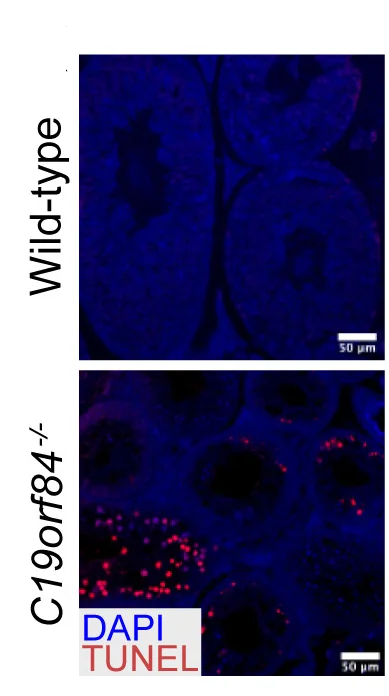 Open access visualization of Microscopy, Adult Testis, Apoptotic Cells, TUNEL Assay, Mice