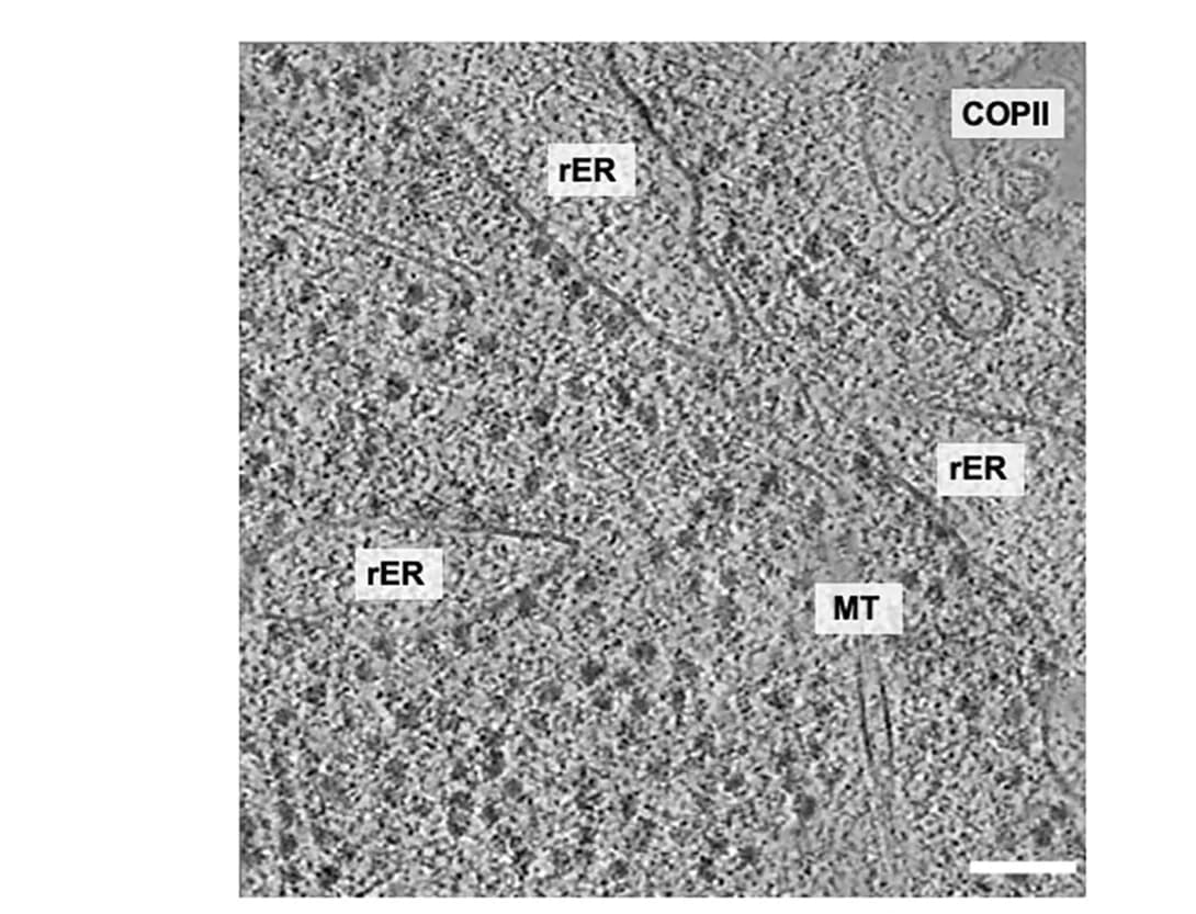 Open access visualization of Microscopy, Tomogram, MEF Cells, Control