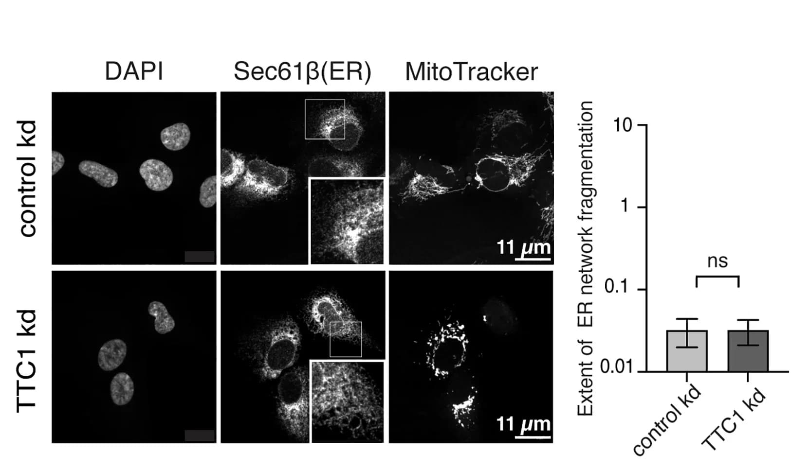 Open access visualization of Bar Plot, Error Bars, Microscopy, Photo, TTC1 Depletion