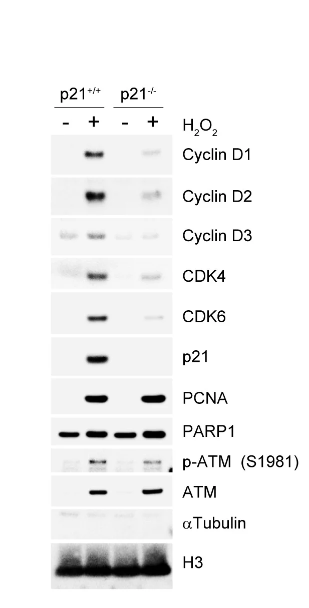 Open access visualization of Gel, U-2OS Cells, Hydrogen Peroxide, Cell Fractionation, Immunoblotting