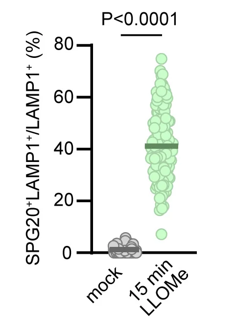 Open access visualization of Scatter Plot, Quantification, SPG20, Lysosomes, HeLa Cells