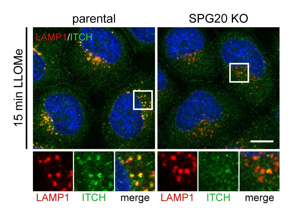 Open access visualization of Microscopy, ITCH, SPG20, LAMP1, Knockout Cells