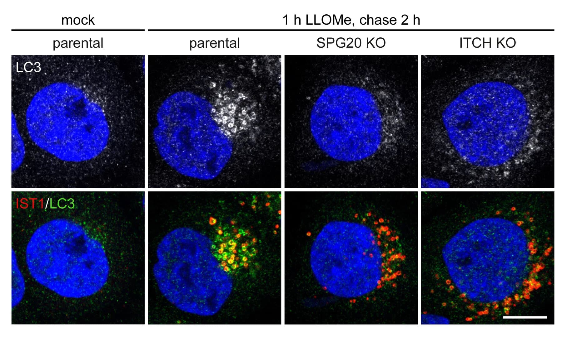 Open access visualization of Microscopy, HeLa Cells, ITCH KO Cells, SPG20 KO Cells, LLOMe Treatment