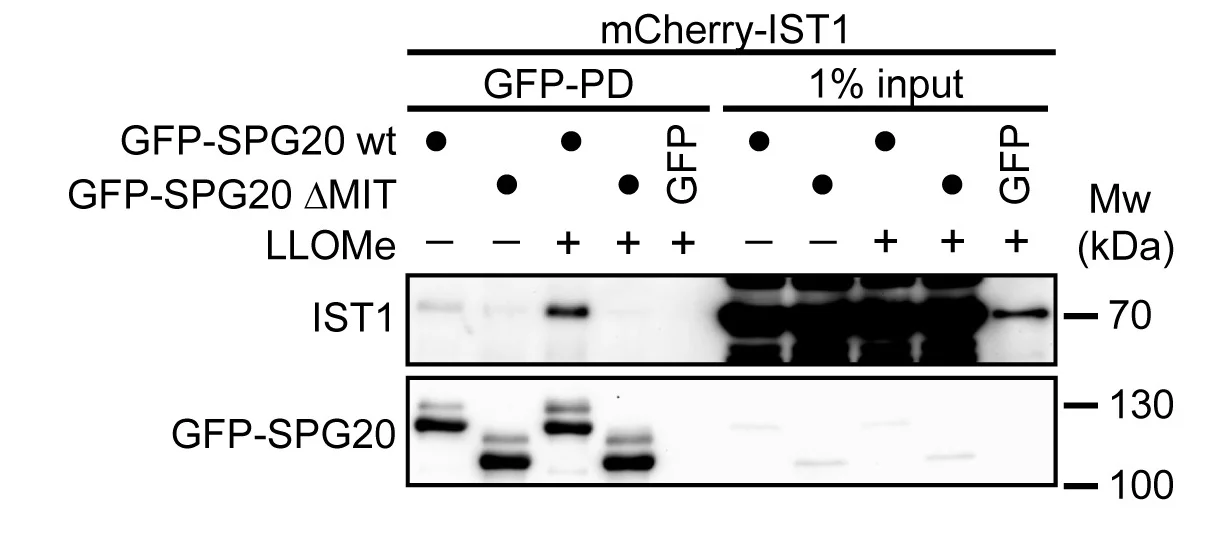 Open access visualization of Gel, LLOMe, SPG20, IST1, SPG20-MIT Domain