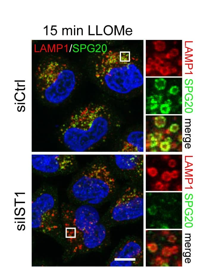 Open access visualization of Microscopy, SPG20, LAMP1, Costaining, LLOMe