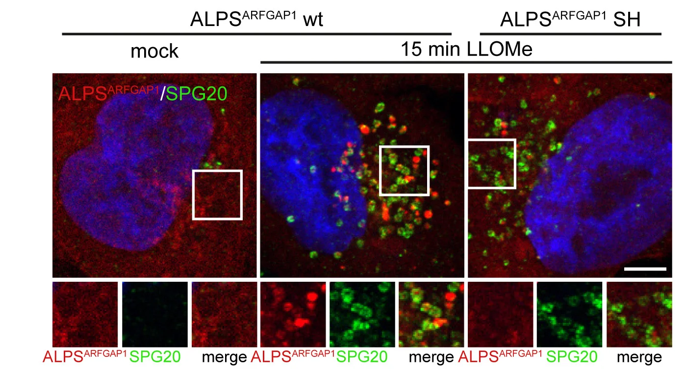 Open access visualization of Microscopy, Lysosomal Damage, Lipid-Packing Defects, Cells, mCherry Fusions