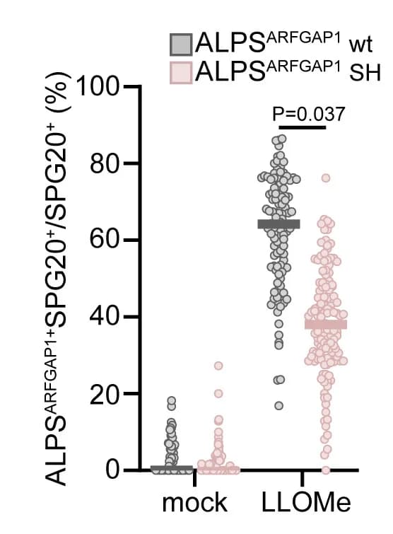 Open access visualization of Scatter Plot, Quantification, Colocalization, ALPSARFGAP1, SPG20