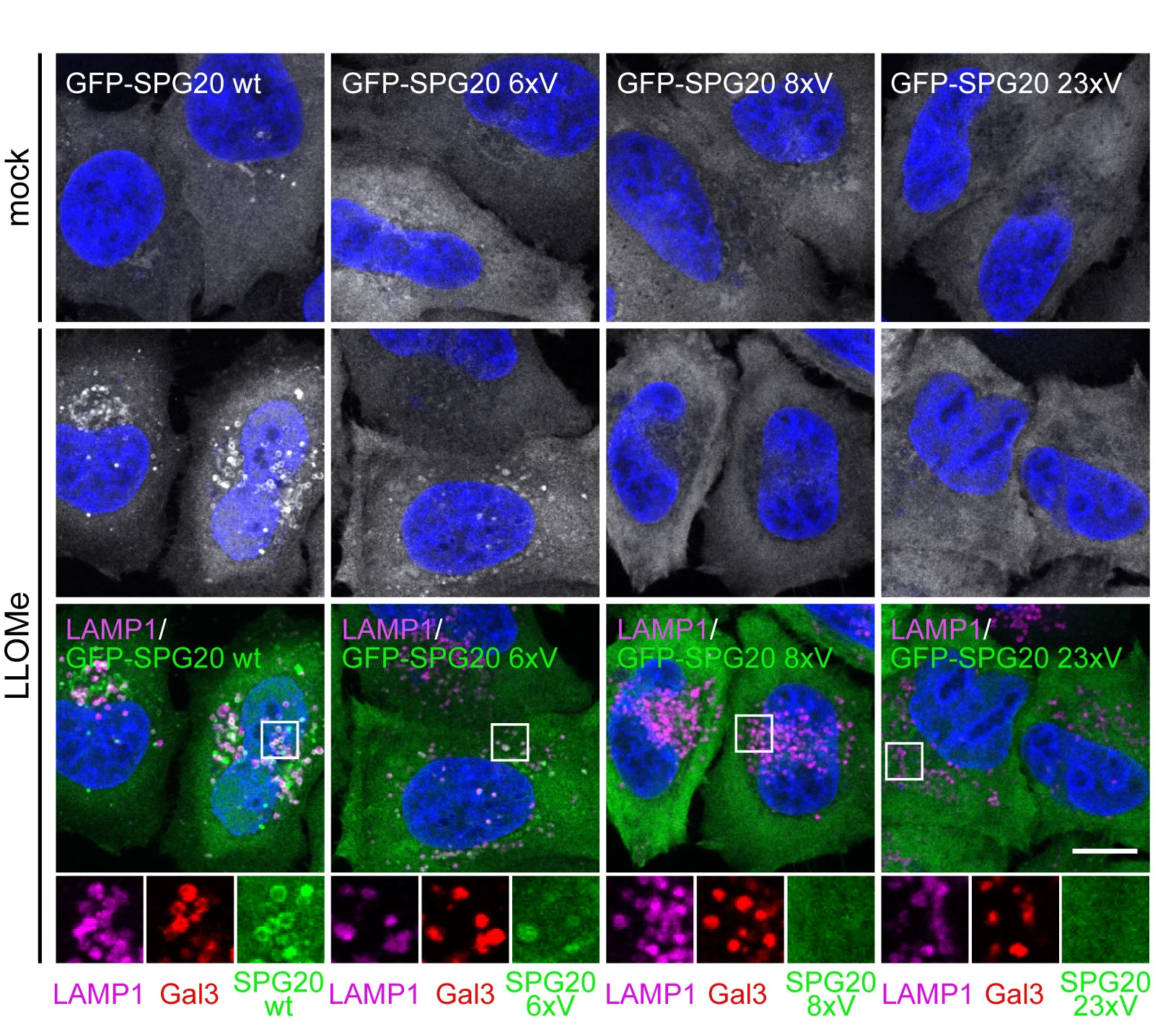 Open access visualization of Microscopy, Translocation, SPG20, Damaged Lysosomes, Hydrophobic Residues