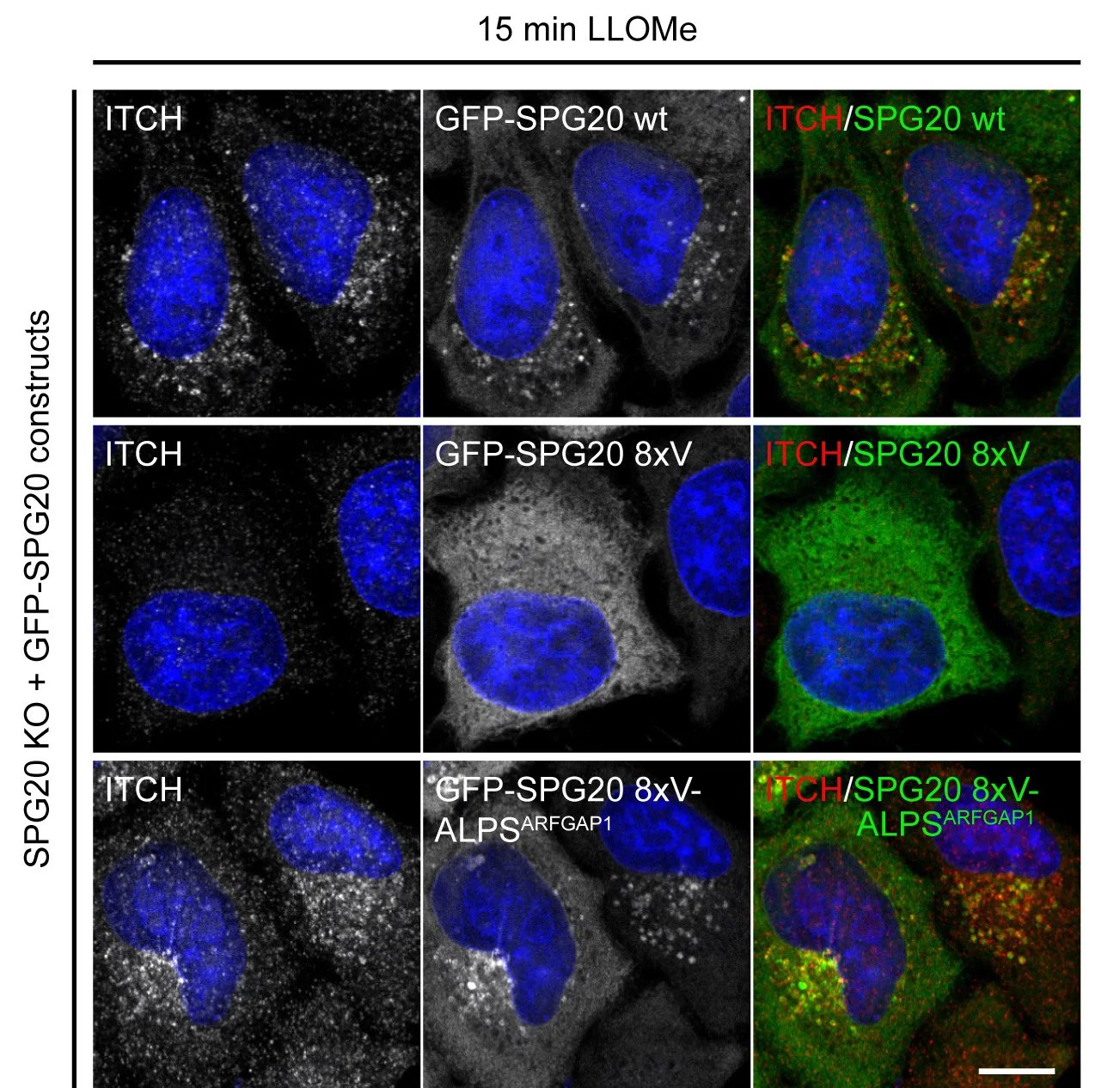 Open access visualization of Microscopy, Translocation, SPG20, Recruitment, ITCH