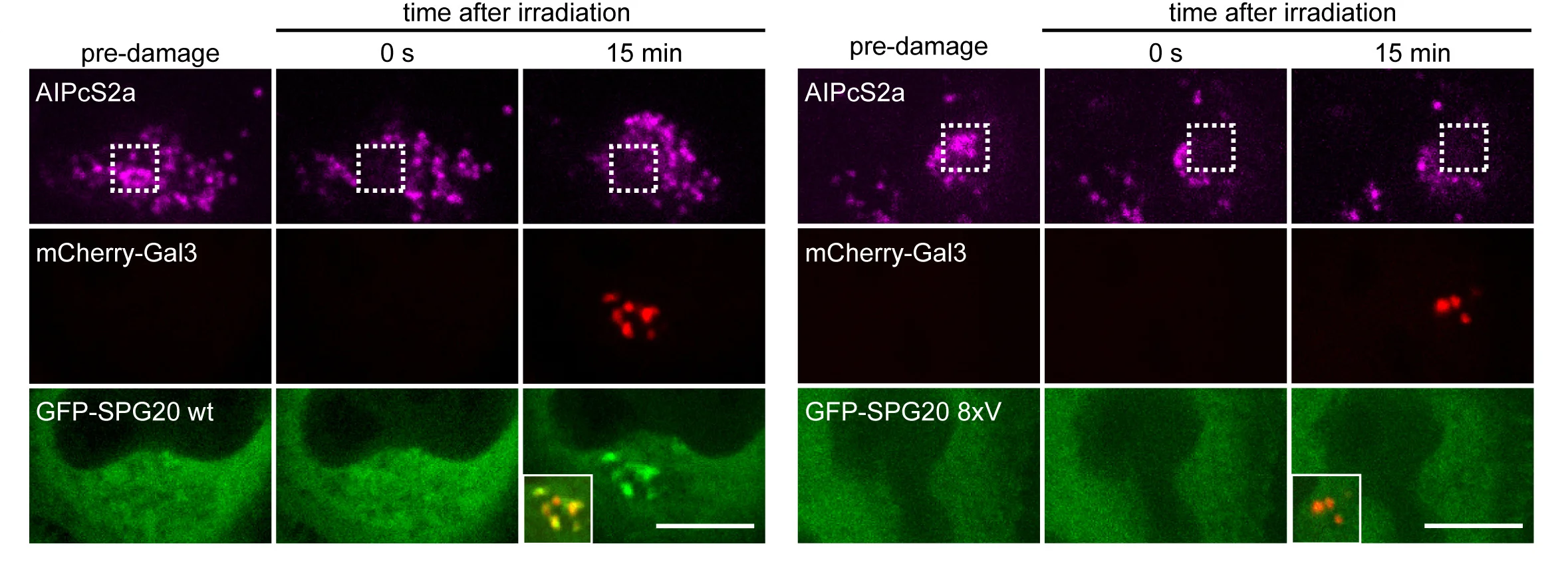 Open access visualization of Microscopy, Lysosomes, SPG20 WT, 8xV mutant, mCherry-Gal3