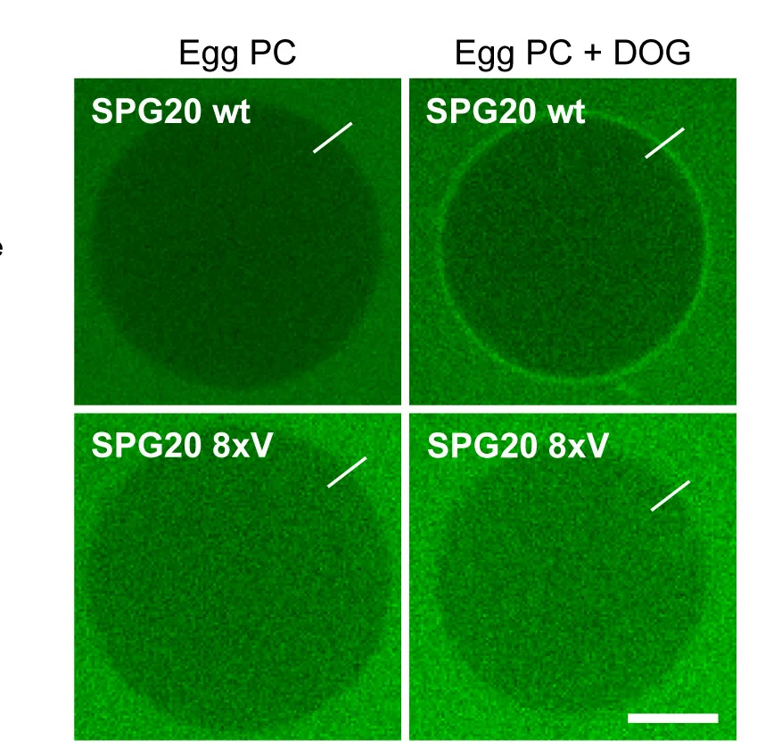 Open access visualization of Microscopy, Binding, SPG20, Lipid-Packing Defects, GUVs