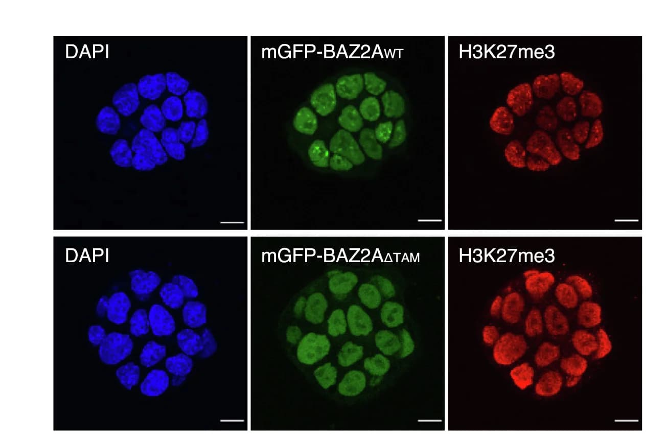Open access visualization of Microscopy, Immunofluorescence, BAZ2A, H3K27me3, ESC